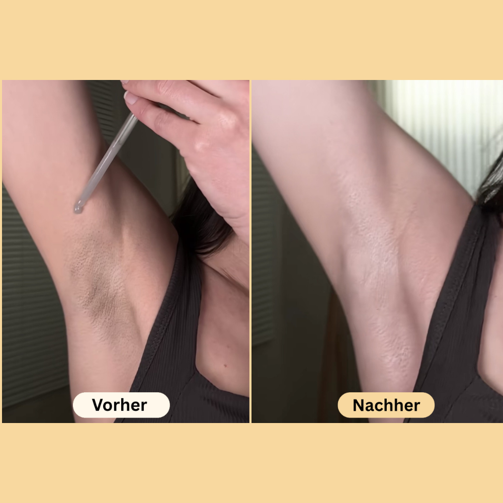 Breava™ | Peel Shot