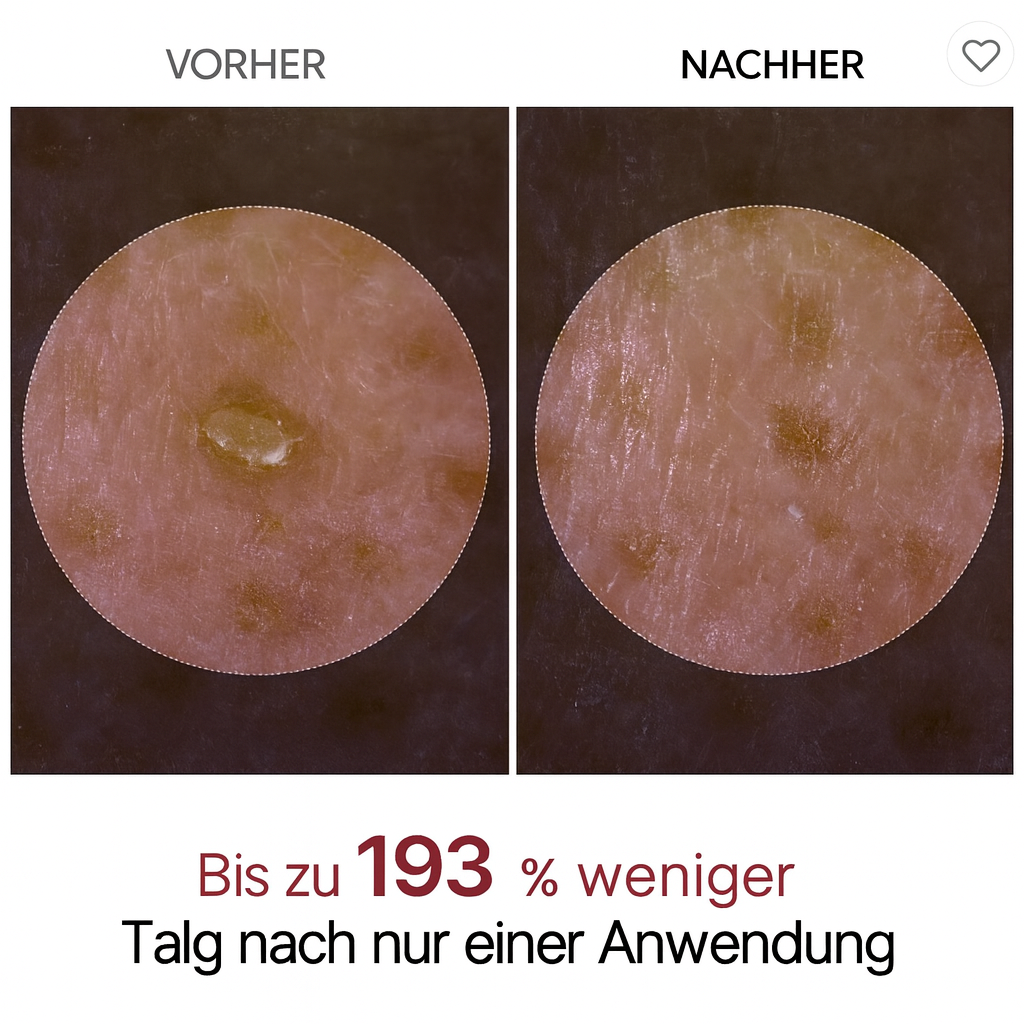 Breava™ | Peel Shot