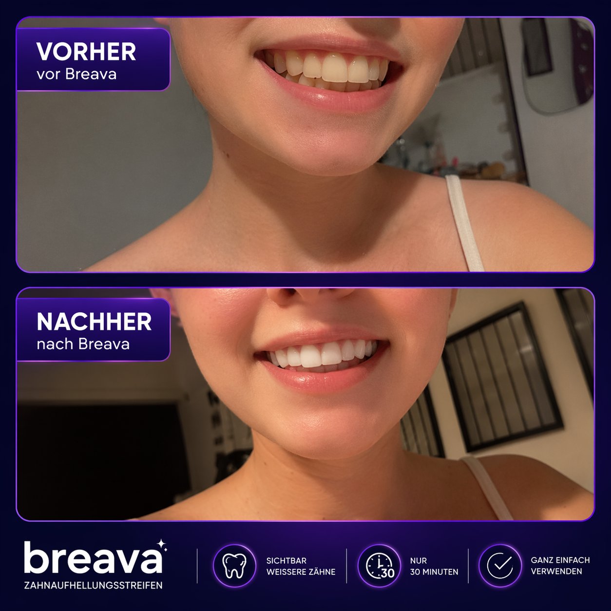 Breava™ | Whitening Strips