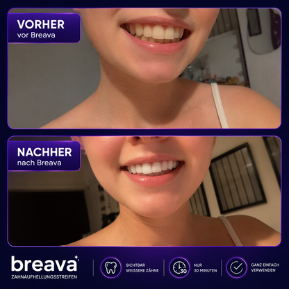Breava™ | Whitening Strips